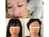 【小顔】人気No.3 ソフウェーブライト★脂肪燃焼,引き締めでキュッとした小顔
