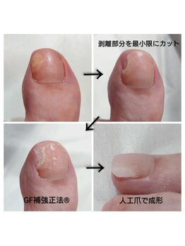 アンティ(Aunty)/爪の成形