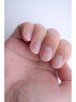 リエル(Liel)の写真/清潔感を味方に地爪を整える習慣を。巻き爪などのトラブルネイル対応やメンズネイルケアも始まりました☆