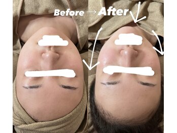 ラ ブリエ(La Briller)/ハーブ+潤いパック+速攻小顔