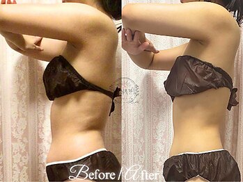 ラナンスパ(RANUN SPA)/即実感で"痩せたね"が嬉しい♪