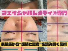 アネム(Anemu lune)