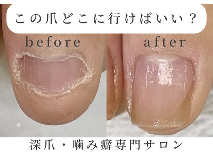 ネイルサロン ミノアッカ(mino'aka)の写真