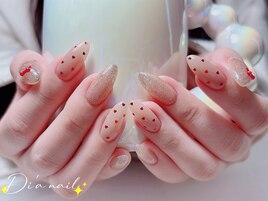 定額/フィルイン/パラジェル