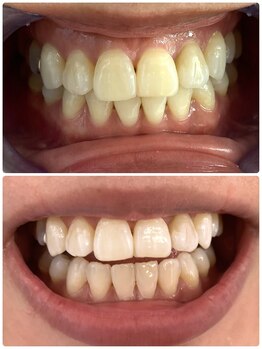 ルルネイル(Lulu Nail)/月一万円で通い放題