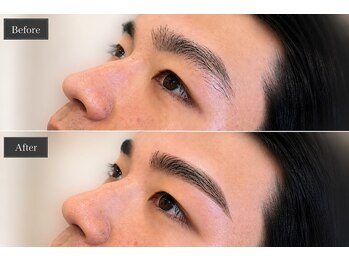 ベルバイグレイス(BELLE by grace)の写真/≪新登場☆≫眉毛の毛流れを整えるブロウリフトと産毛をwax脱毛☆選べるメニューで理想の眉毛をご提案♪