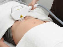 ケトリーナ/(メンズ脱毛)濃いVIOもキレイに!