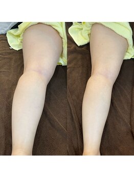 モゼ(moze)/プライムセラム