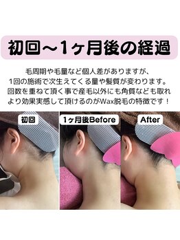 ルル(RuRu)/たった1回でこの効果！！