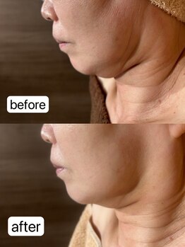 モストブリヤン(MOSTBURYAN)/レモンボトル