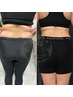 【本気で体重を落としたい方】-8kg 減！耳ツボダイエット＋マシン体験　70分