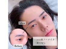 アンバーレス(AmberRes)