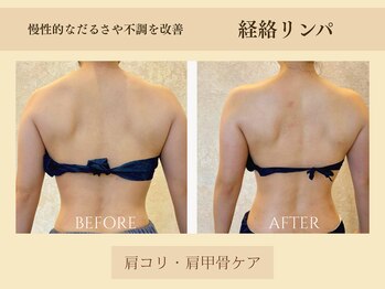 エイミー(Aimee)/【経絡リンパ】ビフォーアフター