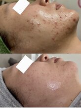 カルナ(CARNA)/【艶玉肌フェイシャル】セルマン