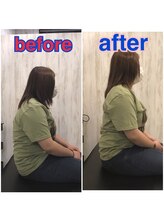 くすの樹接骨院 整体院 鳥栖院/整体/骨盤矯正ビフォーアフター