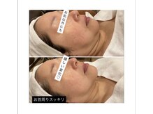 トータルエステティック ジョワイユ(JOYEUX)/疲れ顔→好かれ顔へ