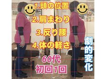 マナリノ(Mana Lino)/初回で劇的変化！！！