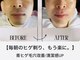 ビビ イーストフィールド 天白 名古屋(vivi)の写真