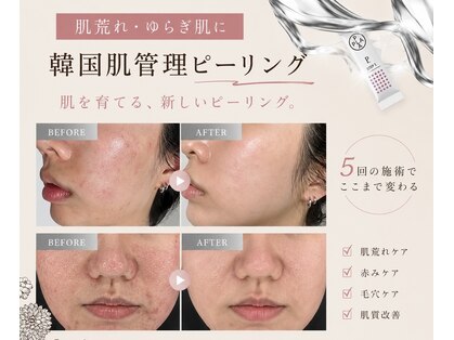 ルアンエステティック(RUAN esthetic)の写真