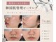 ルアンエステティック(RUAN esthetic)の写真