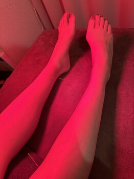 アルバ暁子鍼灸治療院(alba暁子鍼灸治療院)/足の冷えやむくみ