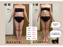 ココロミ(cocoromi)/ハイパーナイフ