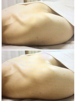 サロン アイミー(salon i me)/【バストアップ・巻き肩】症例