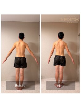 女神デトックス 西宮店(女神DETOX)/ビフォーアフター