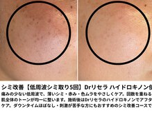 パルテール/シミ・くすみ・赤みがお悩み