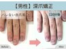 【再発させない深爪矯正】男性ハンド/即日見た目改善