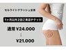 セル脂肪分解マシン全身【1ヶ月以内2回分チケット】¥24.000→¥21.000