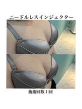 サラ/ニードルレスインジェクター