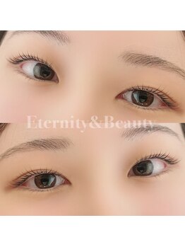 エタニティ アンド ビューティー 浅草(Eternity&Beauty)/ナチュラルまつ毛パーマ