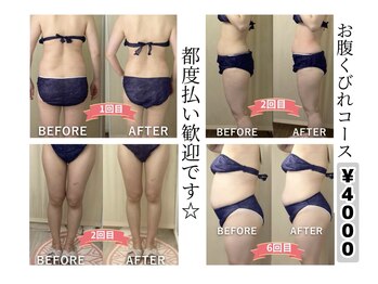 ヒトハナ(hitohana)