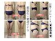 ヒトハナ(hitohana)の写真