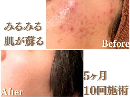 アクール(Accueil)の写真