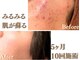 アクール(Accueil)の写真