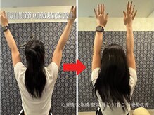 アロエ鍼灸整体院/肩関節可動域改善