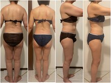 サルサナ(Salu Sana)/before→after　痩身/温熱