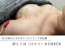 お悩みに合わせたバストアップ美乳鍼♪西宮/バストアップ