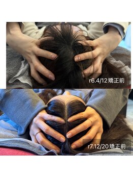 プライミー(PRIMY)/頭蓋骨矯正