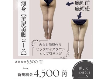 きれい塾 恵比寿/痩身
