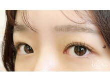 クレー(Klee)/フラットラッシュ