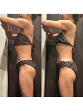 フィエルテ 甲斐敷島(FIERTE)/Before after