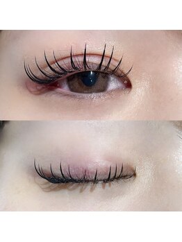 ジーナ 天神(Zina)/パリエク150本