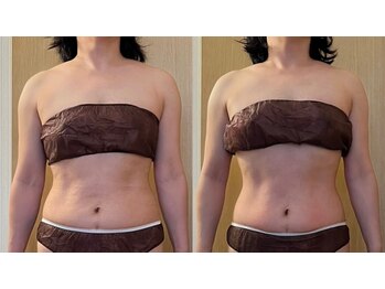 マイティー整骨院 ココア(CoCoa)/セルクラ