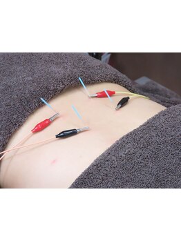 鍼灸施術を受けたい