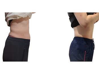 ありよし整骨院/楽トレでシェイプアップ