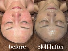 ディアーム 光明池店(Diarm)/