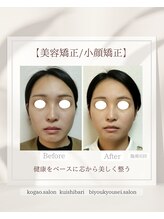イチカ 仙川店( ichika)/フェイスライン